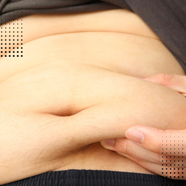 Navel Displacement Treatment